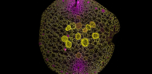A young Marchantia plant (‘gemma’, a clonal bud) visualised using fluorescent proteins that highlight different cell types and structures. Image provided by Edith Forestier.