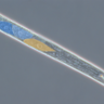 Photo of a cyst nematode's head viewed through a high-power microscope 