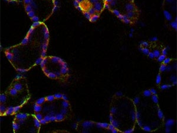 Cell-specific targeting of aequorin to mesophyll cells to measure cell type Ca2+ dynamics. Aequorin-YFP in the cytosol (red), GFP in ER (green) chlorophyll fluorescence (purple). (Martí et al., 2013 Plant Physiology 163, 625 – 634)