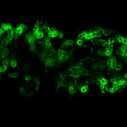 Rice plant colonised by the AM fungus Rhizophagus irregularis grown and imaged in the AM slide. The arbuscule is surrounded by a green fluorescent protein. 