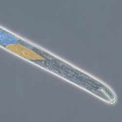 Photo of a cyst nematode's head viewed through a high-power microscope 
