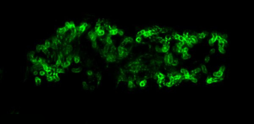 Rice plant colonised by the AM fungus Rhizophagus irregularis grown and imaged in the AM slide. The arbuscule is surrounded by a green fluorescent protein.