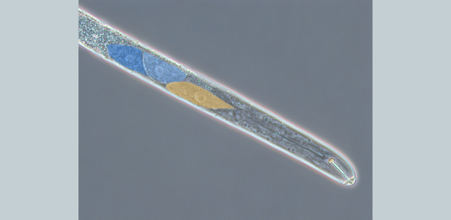 Photo of a cyst nematode's head viewed through a high-power microscope