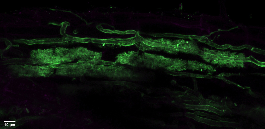 structures formed by arbuscular mycorrhizal fungi (stained green) that have colonised rice roots, imaged on a confocal microscope. Image provided by Jen McGaley.