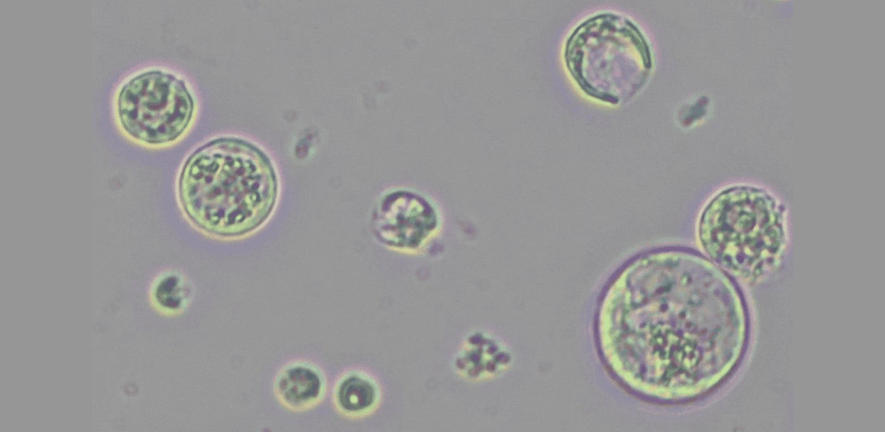 Tomato root protoplasts close up