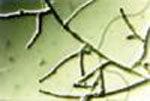 Growth of a fungal colony of R. solani showing branching at the hyphal scale.